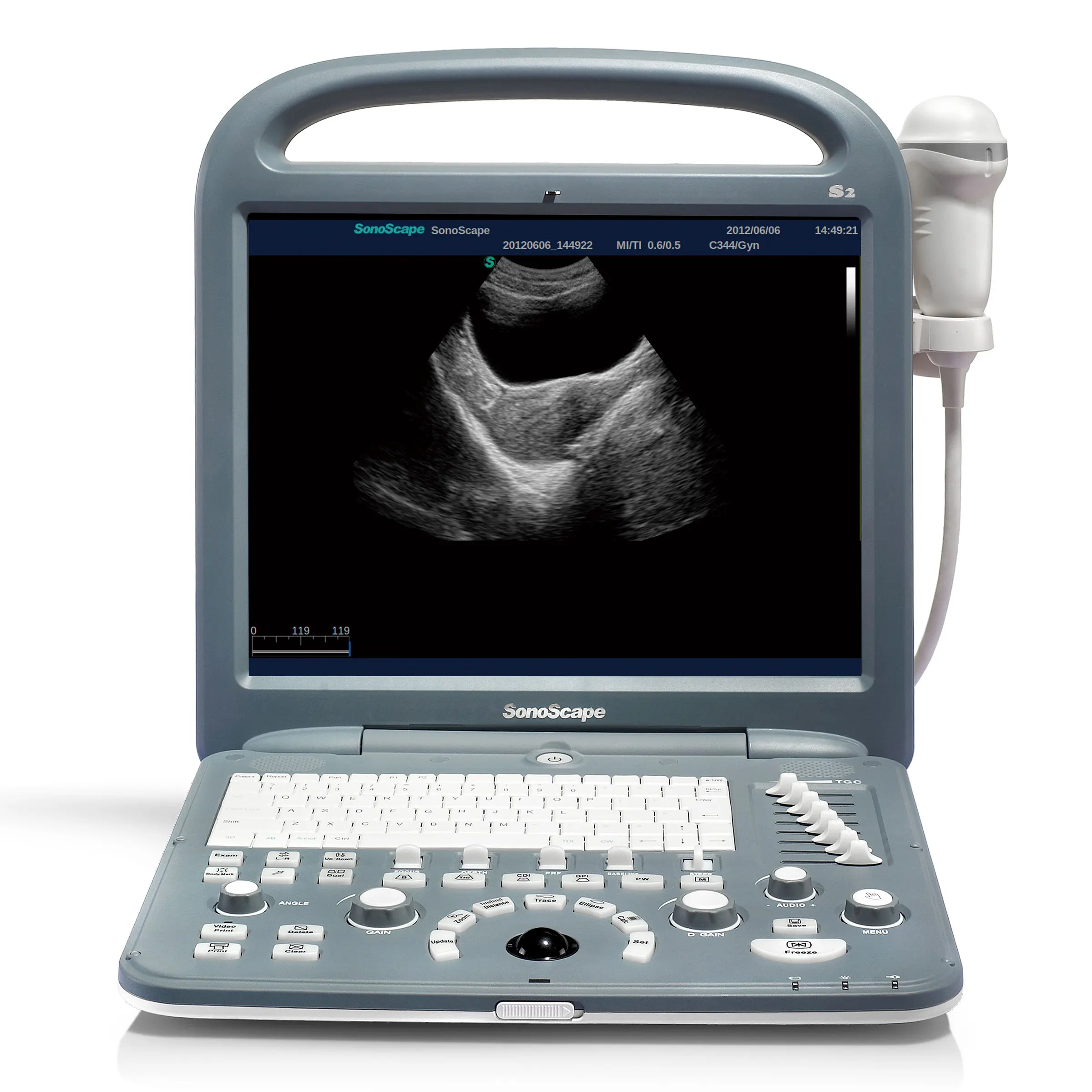 Original S2 Portable Musculoskeletal Ultrasound Machines Ultrasound Portable Cardiac Ultrasound Price