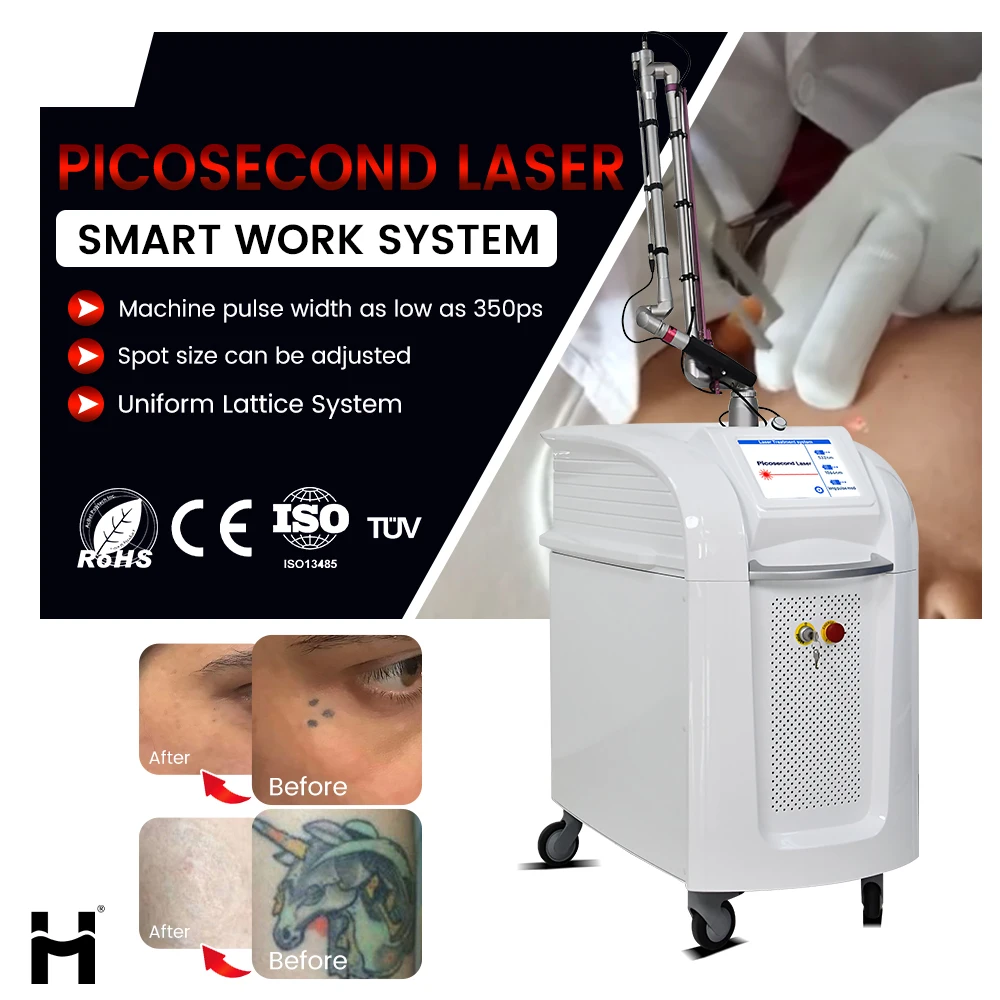 Professional PicoLaser 532 755 1320 1064 Pico Second Tattoo Removal Laser Machine Pico Laser Tattoo Removal Picosecond