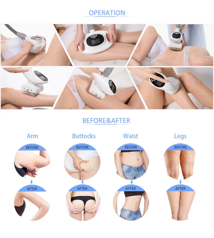 Vacuum Lipo 80k Cavitation Slimming System Liposuction Lipocavitation Shaping Cavitation Rf Engraving Lipase Slimming Machine