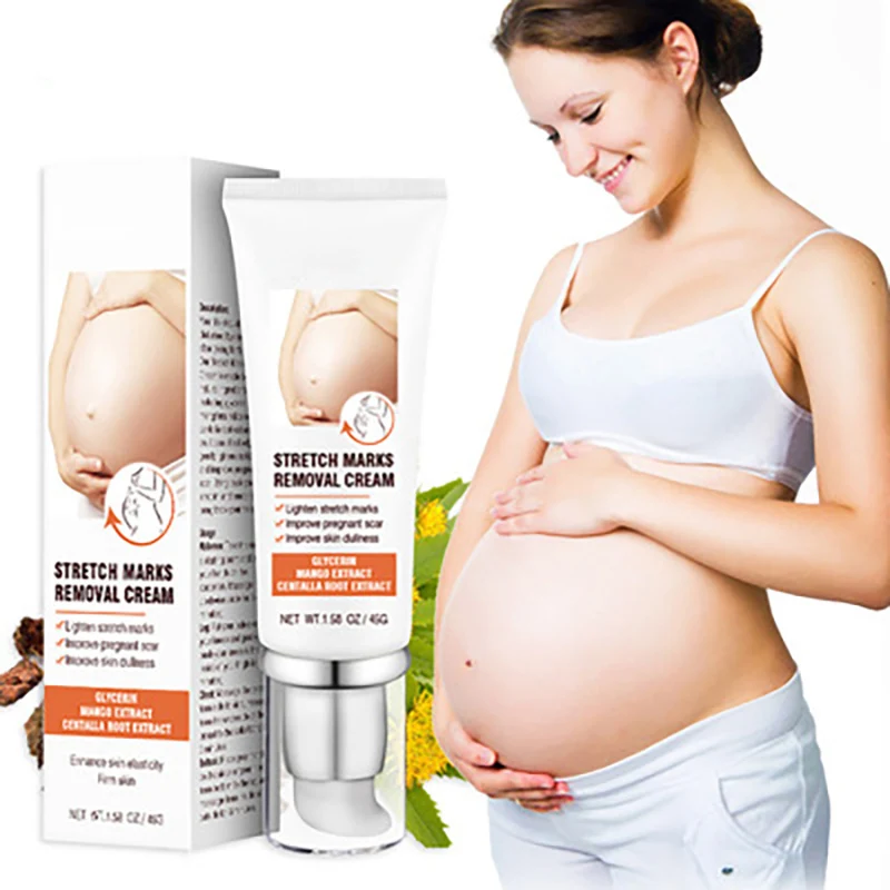Hot Sale Best Natural Organic Herbal Repair Scar Anti Vergeture Vegan Stretch Mark Removal Cream Best Cream For Stretch Marks