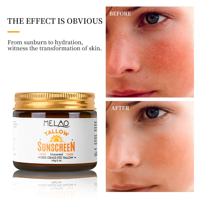 OEM Sensitive Skin Heals And Hydrates With Olive Oil Moisturizing And Smooth Grass-fed Sun Beef Tallow