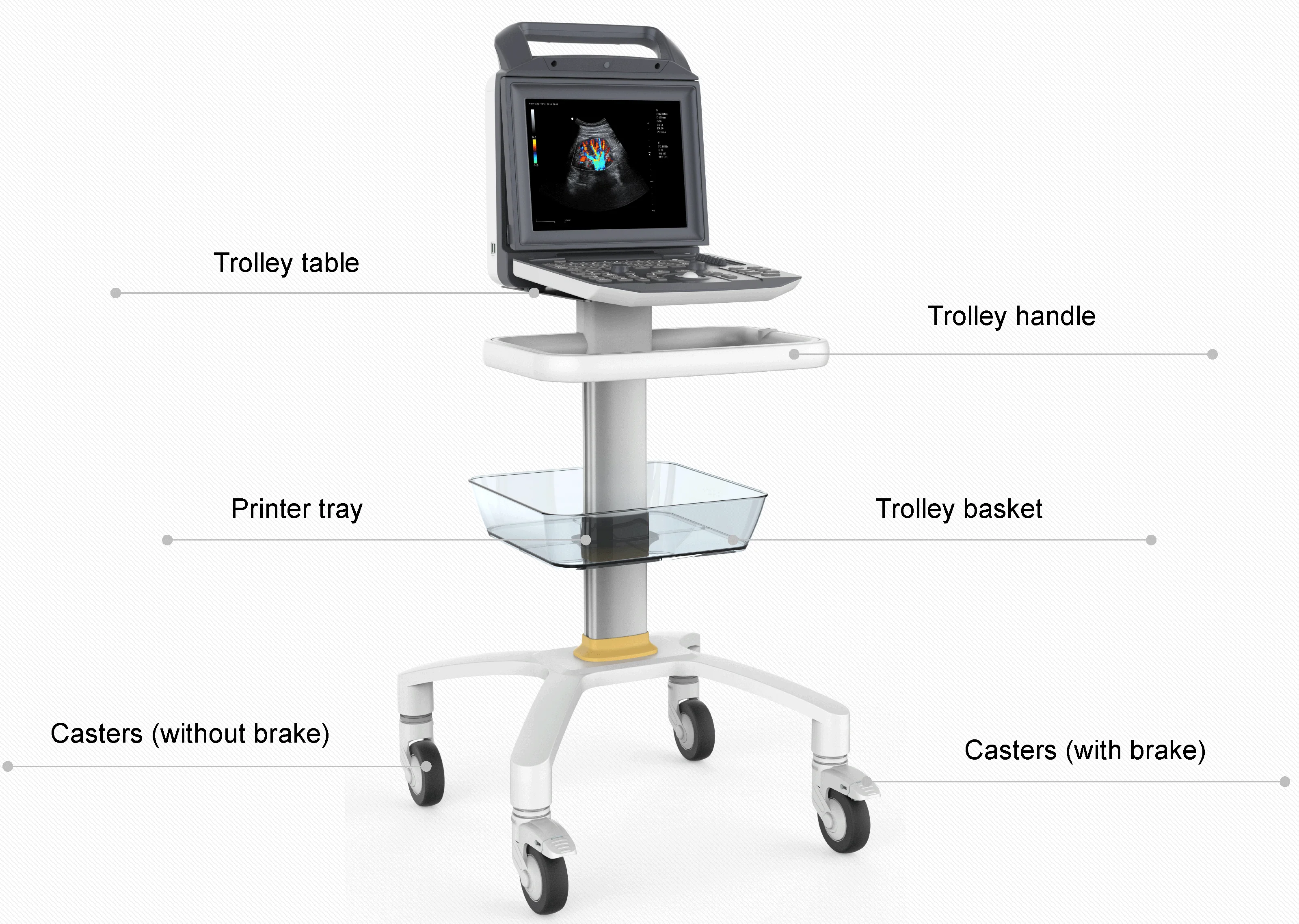 Medico Ecografo Portatil Ultrasonido Portable Color Doppler CW TDI Cardiac Ultrasound Machine Price