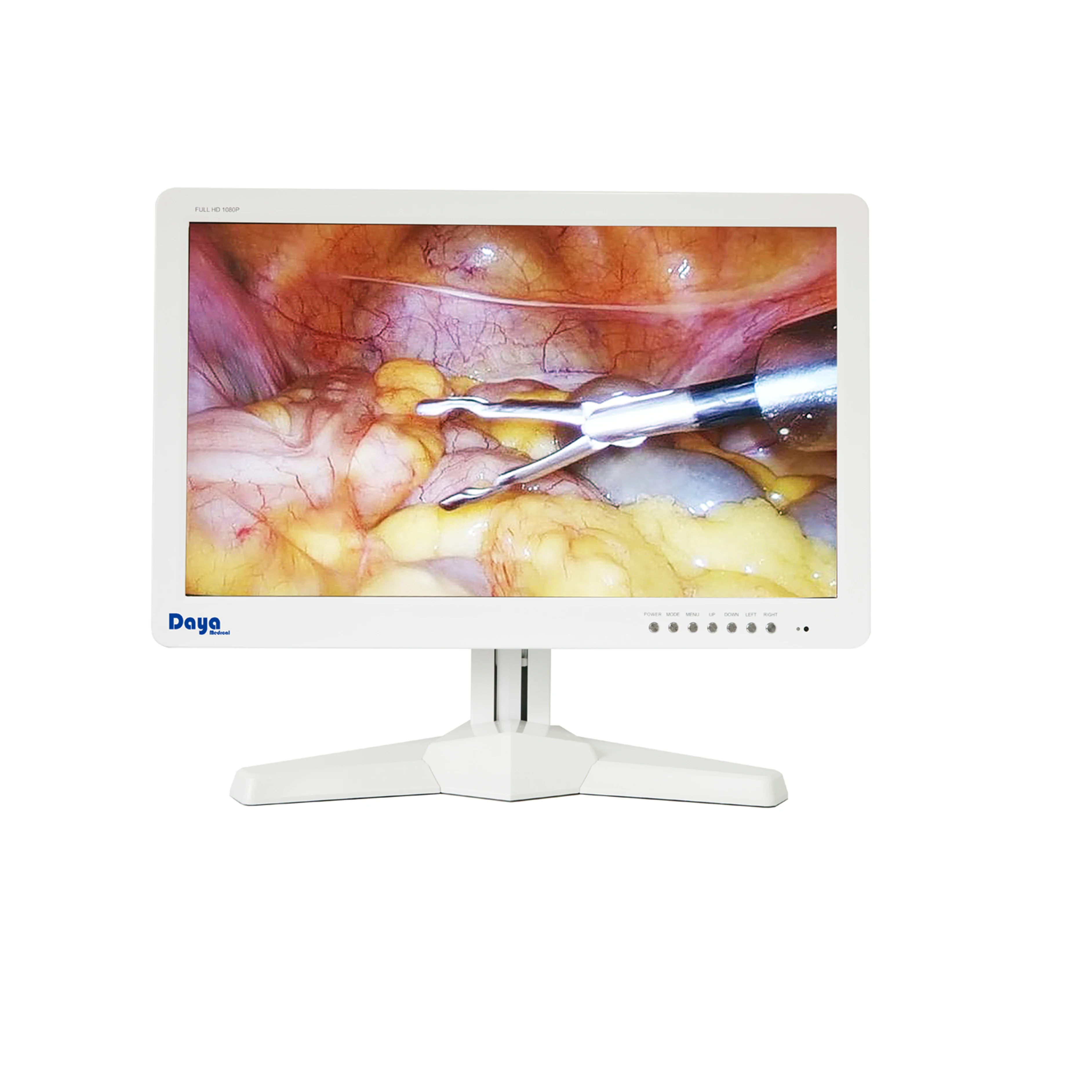 Full HD LED-подсветка технология медицинского класса монитор