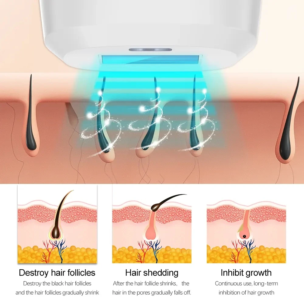 Household laser hair removal machine Sapphire Ice Feeling Painless Ipl Laser Hair Removal device for facial bikini artpit les
