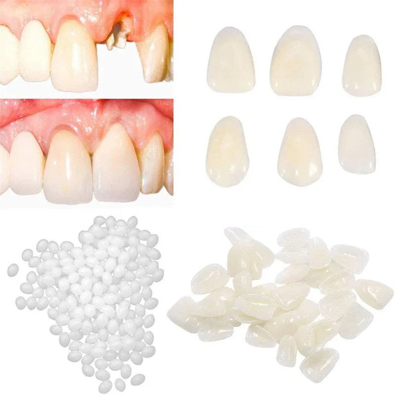 High Quality Dental Temporary Crown Veneers Teeth Dental Materials CE Composite Porcelain Veneer Resin Light Cure Anteri Manual
