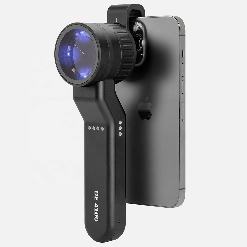 IBOOLO DE-4100 PRO 365nm uv light handheld 365nm uv light manual type dermatoscope for surgical instrument essentials