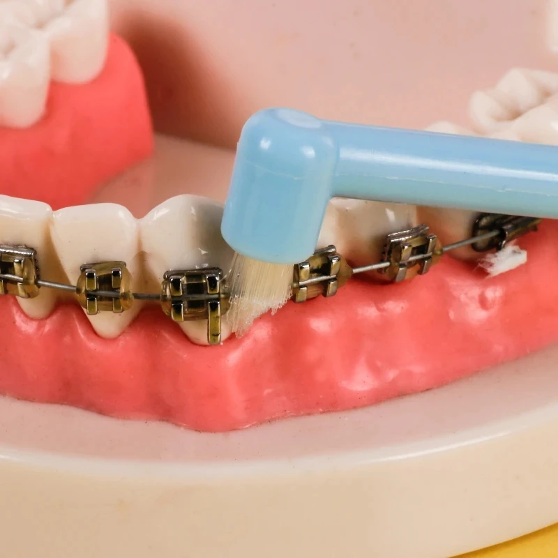 Orthodontic Braces Cleaning Toothbrush Soft Interdental Decayed Tooth Stain Eraser Brush Small Head mono-tuft toothbrushes