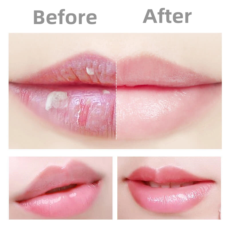 Arnica Balm Lip Balm Kit Lip Balm Manufacturers 2023 New Product