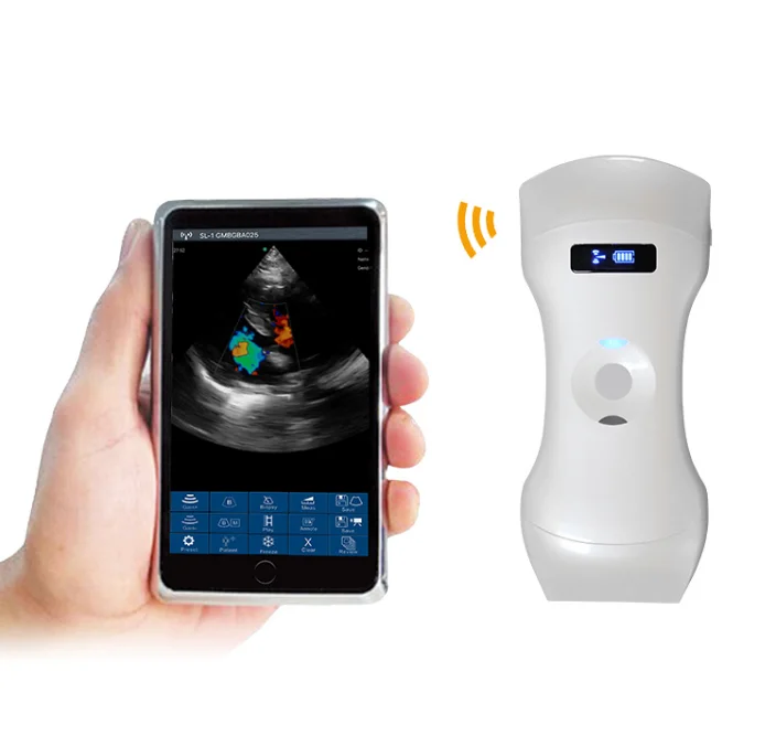 MC26 192 elements highest configuration 3 in 1 wireless ultrasound probe for cardiac, vascular and kidney