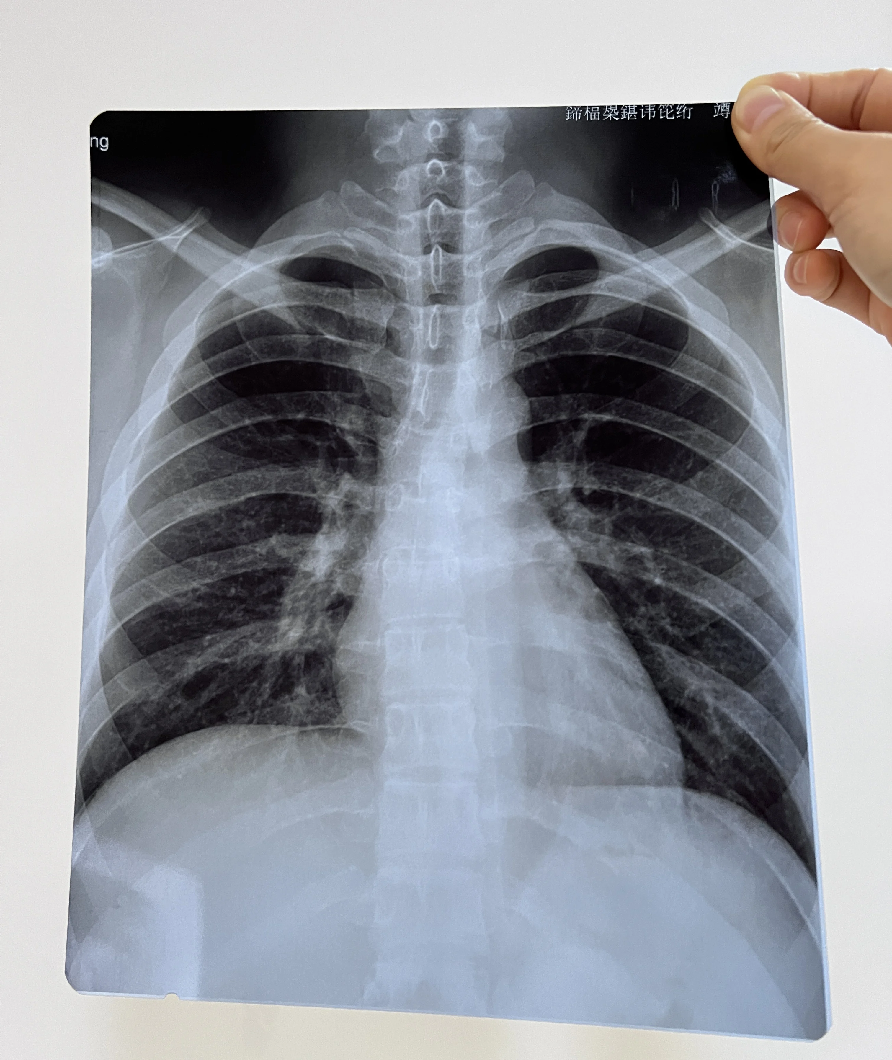 Wholesale A3 Custom Size Sheets Rolls Blue Inkjet Medical Film for Medical Image Printing X Ray CT, CR, DR, MTR, PET-CT etc.