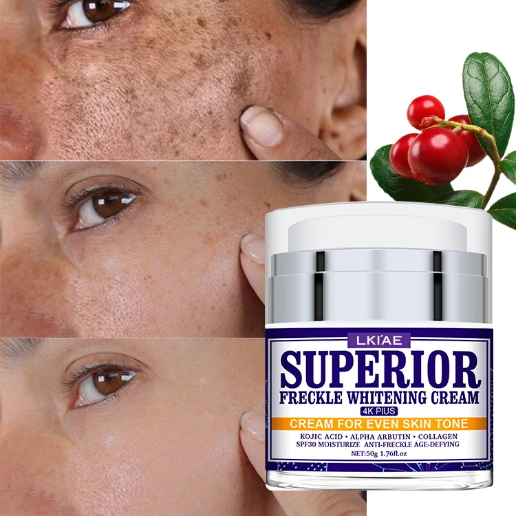 Private Label Skin Powerful Whitening Freckle Removal Face Bleaching Cream