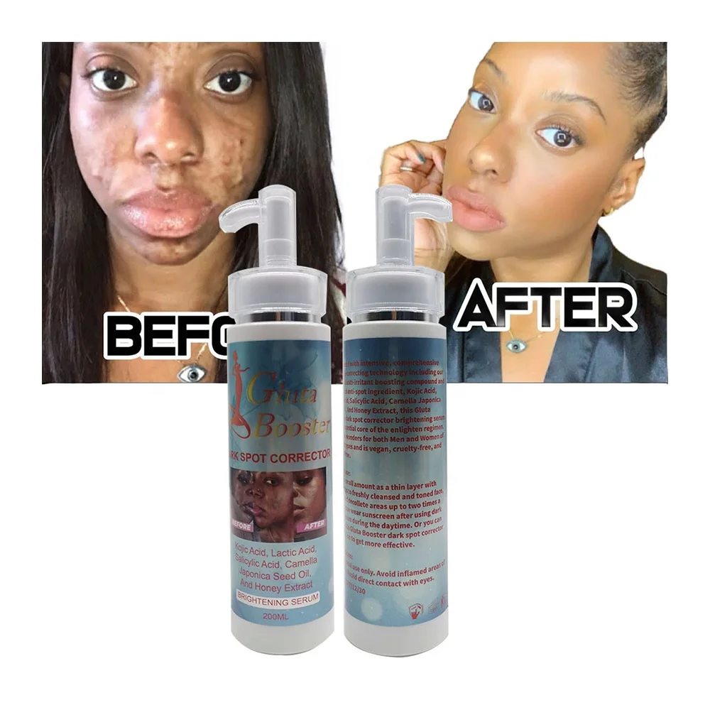 Private Label Fading Dark Spots Lightening Hyperpigmentation Freshing Skin Fast Absorbing Serum Moisturizing for Black Skin