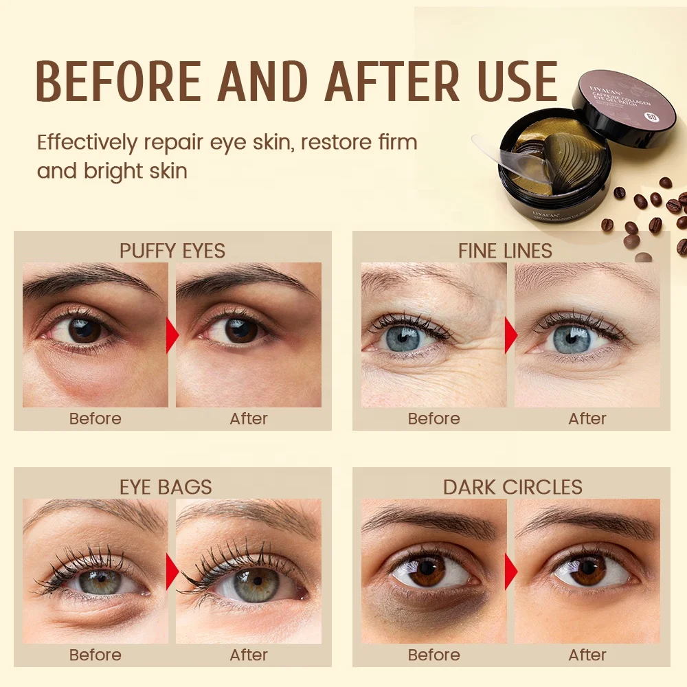 Private Label Lighten Dark Circles Fine Lines Wrinkle Eye Bags Hydrogel Vegan Caffeine Under Eyes Patches