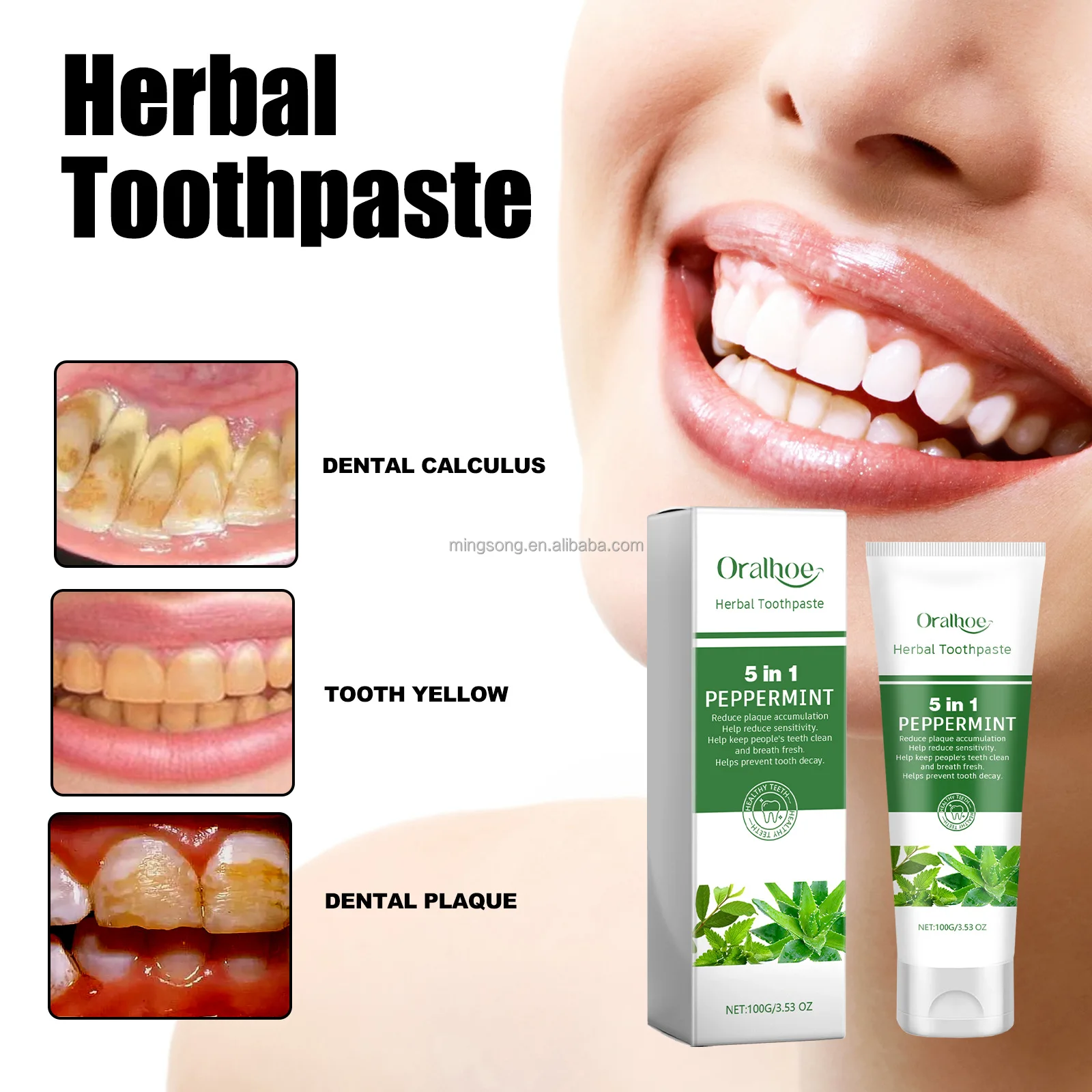ORALHOE Oral Refreshing Whitening For Sensitive Teeth Natural Herbal Licorice Peppermint Aloe Vera Toothpaste 100ml