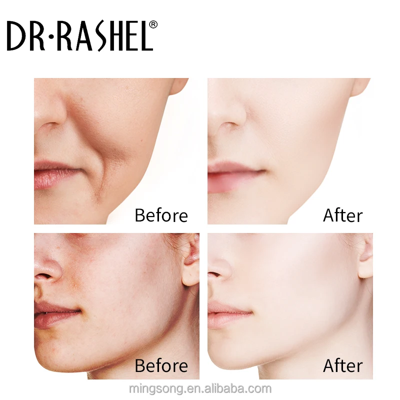 Dr Rashel 3 PCS Brightening Anti Aging Acne Scar Repairing Face Skin Care Serum Vitamin C Retinol Facial Serum Set