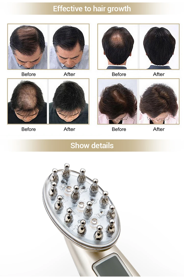 Laser Massage Comb Women Hair Scalp Massage Comb Stimulate Collagen Regeneration For Hair Follicle Repairing