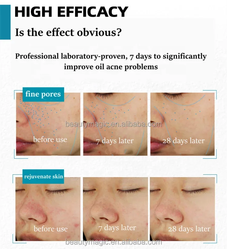 original la Effaclar Serum Retinol B3 Pure Vitamin C10 Hyalu B5 Niacinamide 10 Cicaplast B5 Moisturizing 30ml