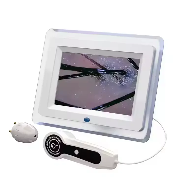 The New Listing Scalp Analysis Hd Detector Skin Machine Beauty Salon Home Follicle Kin And Hair Analyzer