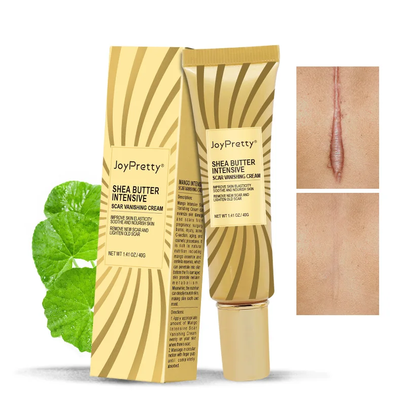 Herbal Acne Spots Treatment Burn Surgical Scars Smooth Whitening Face Body Skin Care Acne Scar Removal Cream
