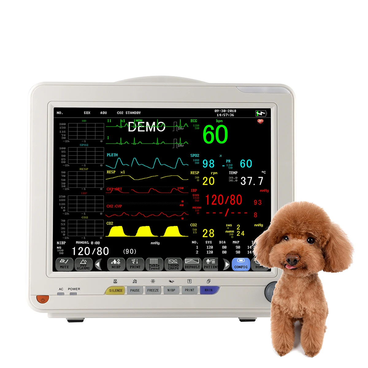Medical Vital Signs Monitor Multi Parameter Monitor Veterinary ICU Portable 12.1 Inch Touch Screen Monitor