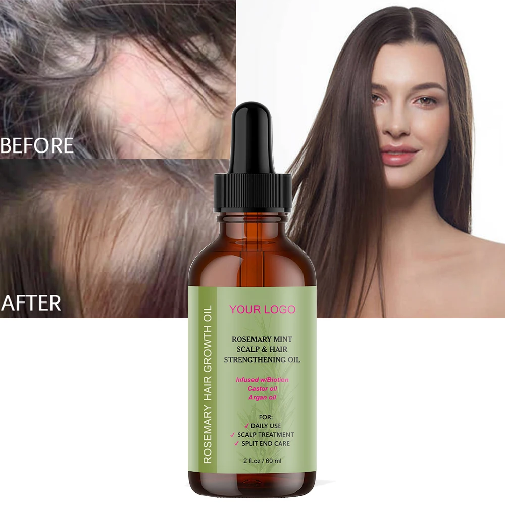 Organic Lavender Rosemary Fast Hair Growth oil for African Alopecia Regrowth Mint Serum for Black Women Hair Loss Product