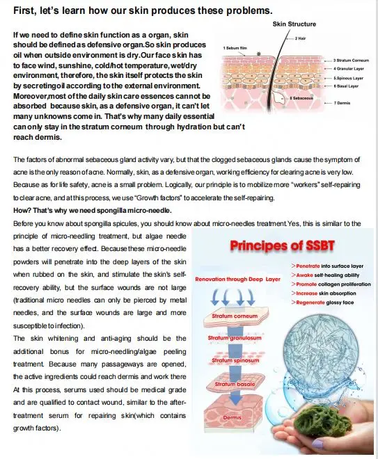 Hot sale 70% Treatment III Spicule Spongilla Spicules Acne skin Cream with Sea Buckthorn Oil