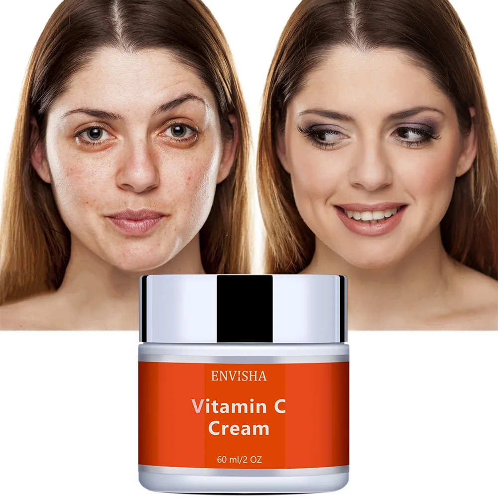 Vegan Organic Vitamin C Face Cream Brightening Face Dark Spot Freckle Removal Cream