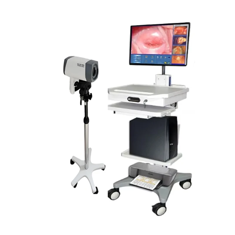 China factory Vaginoscope price Vaginoscope software for Medical equipment OEM service