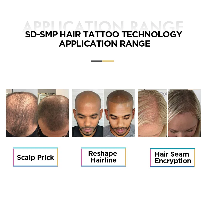 NUOJO Newest OEM SMP Scalp Painless Scalp Micropigmentation Machine pmu Scalp Micro Pigmentation Kit