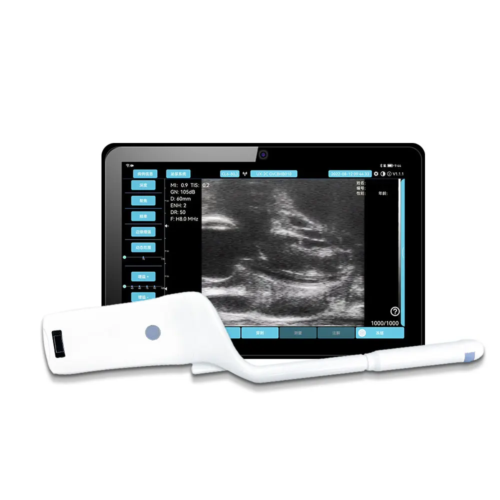 Micro Convex probe and  Linear 6.5 8MHz  wireless wifi handheld ultrasound portable doppler