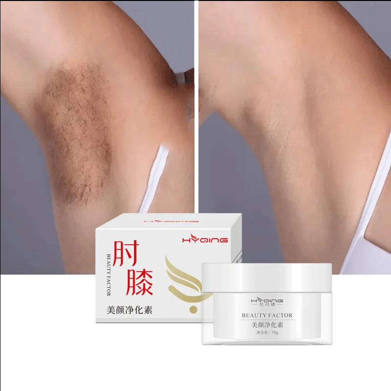 Hot sales Private label OEM skin moisturising lightening body bleaching  dark spot removing skin whitening cream
