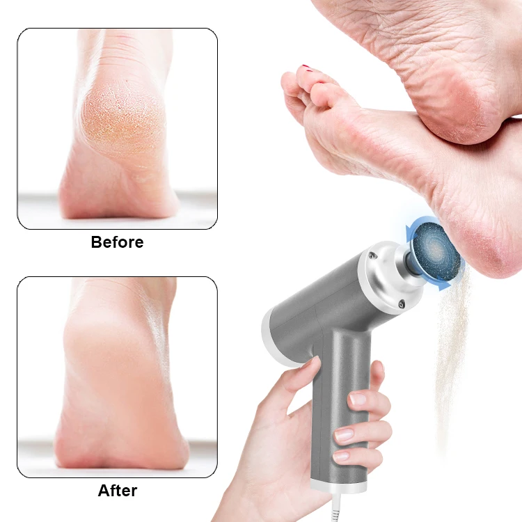 4500RPM Fast Speed Electric Foot Grinder Machine Removing Hard Dead Skin for Personal Feet Care