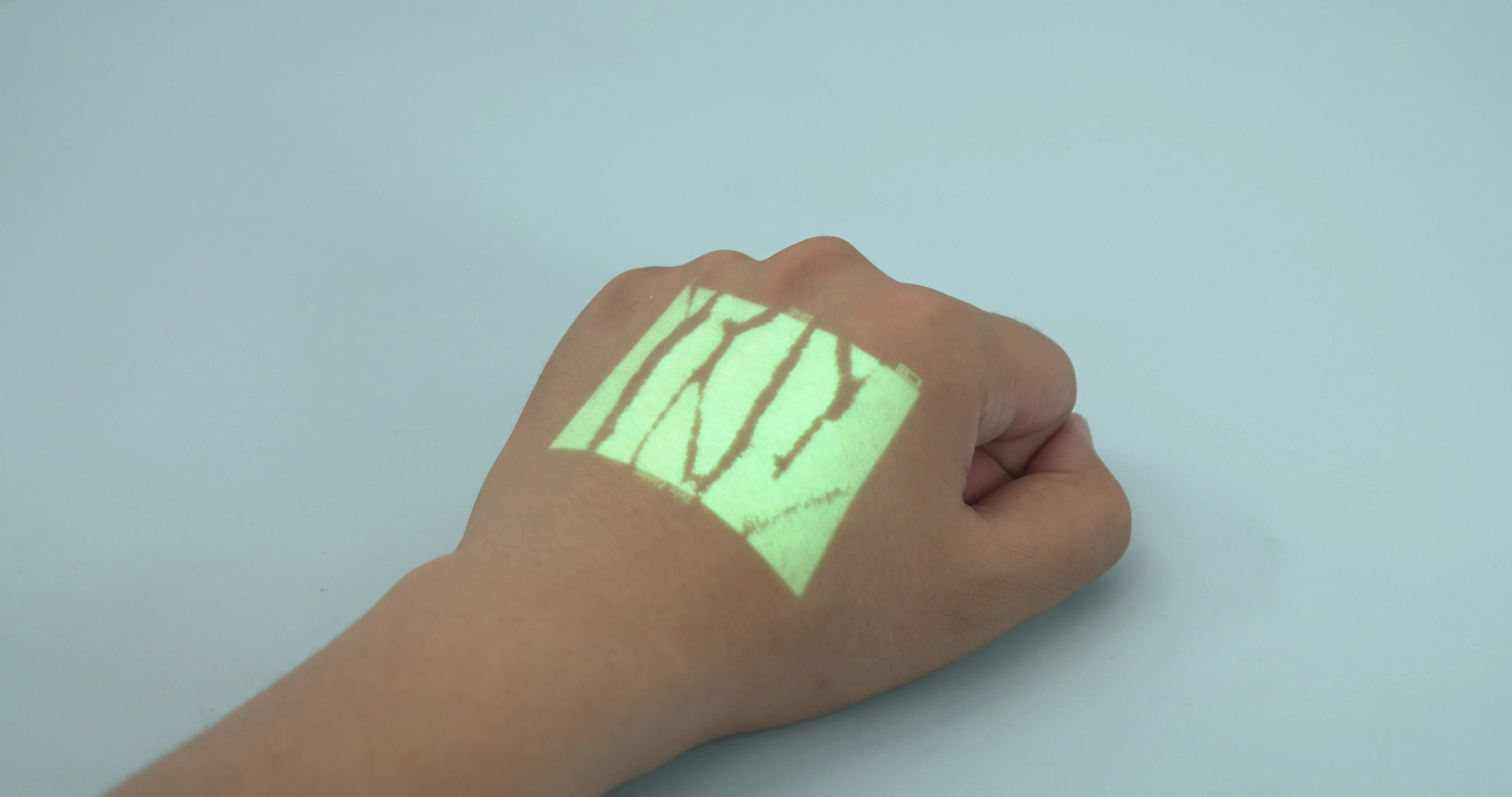 RC-VF500T  rechargeable transilluminator vein finder lamp made in china