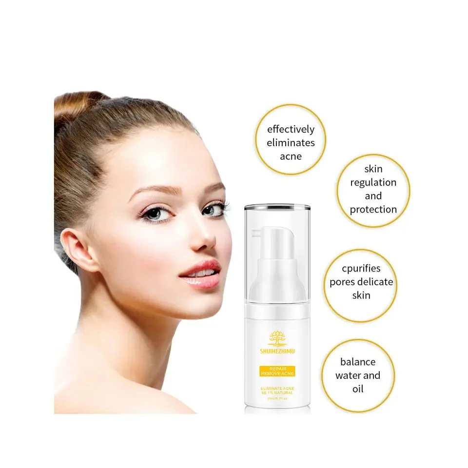 Private Label Anti Acne Cream Organic Herbal Dark Spot Repair Scar Remover Pimple Acne Cream