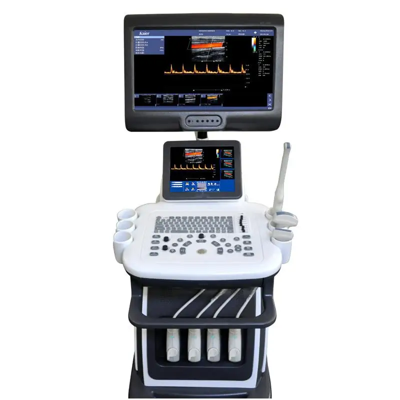 Professional desktop multifunctional color ultrasound diagnostic examination suitable for the human body ultrasound scanner