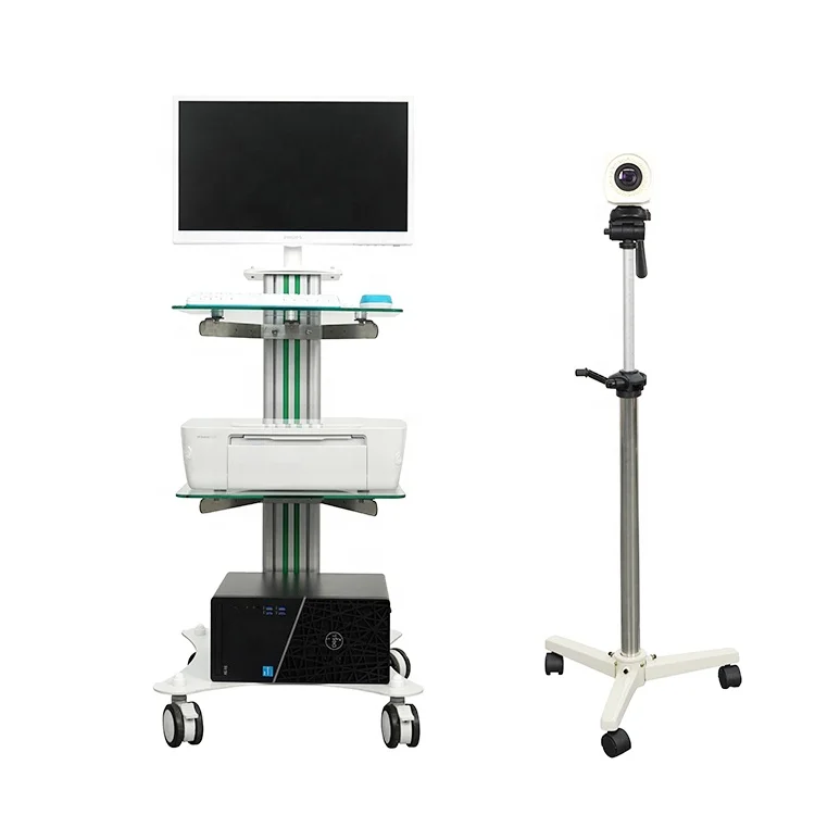 Advanced Technology Dynamic Video Colposcope Price