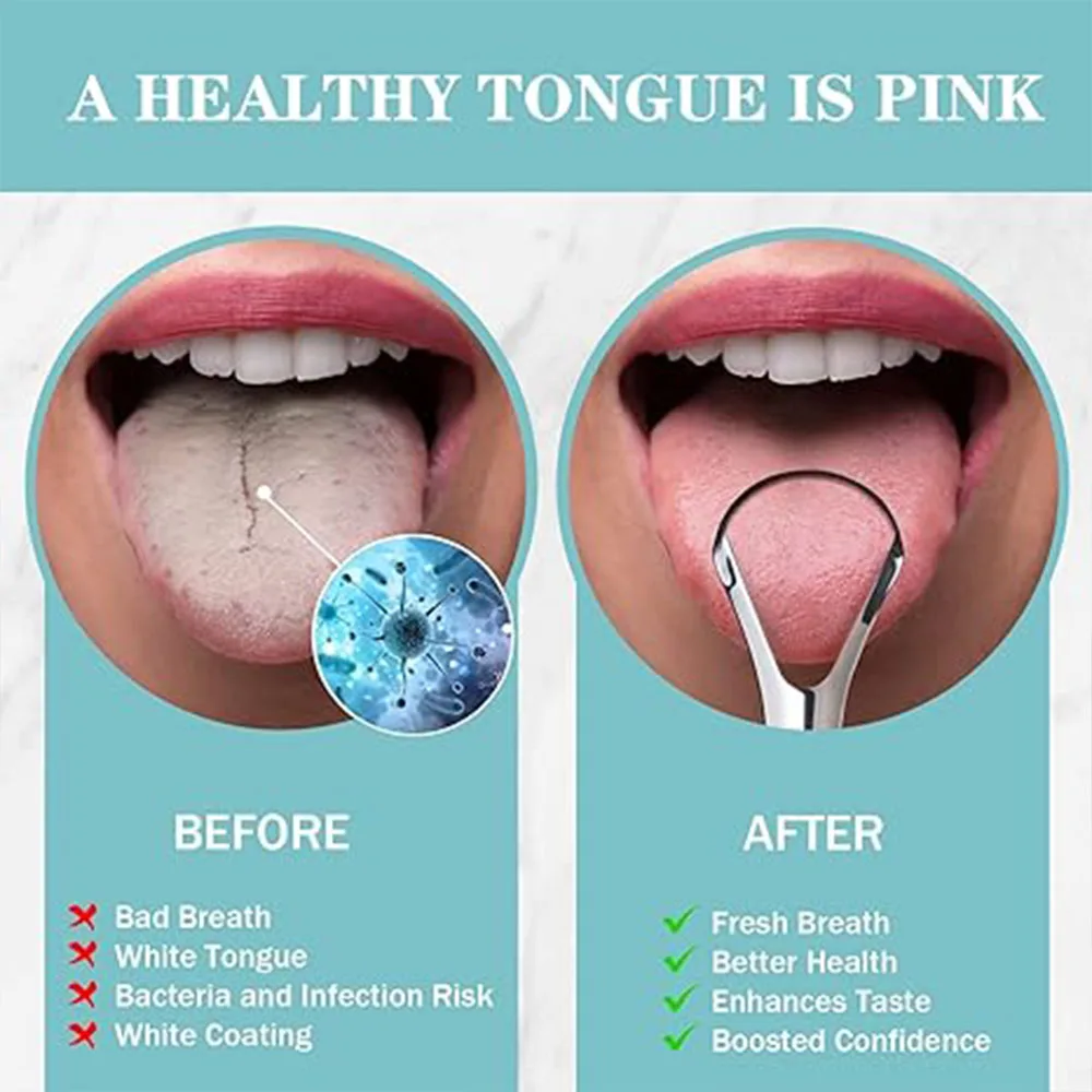Stainless Steel Tongue Scraper with Case Mouth Cleaner to Remove Bad Breath Conveniently Packaged in Box