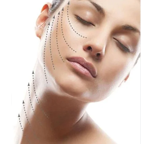 Cosmetics Korean Cog 4d 19g 100mm Hilos Tensores Korean Collagen Threads With L Cannula