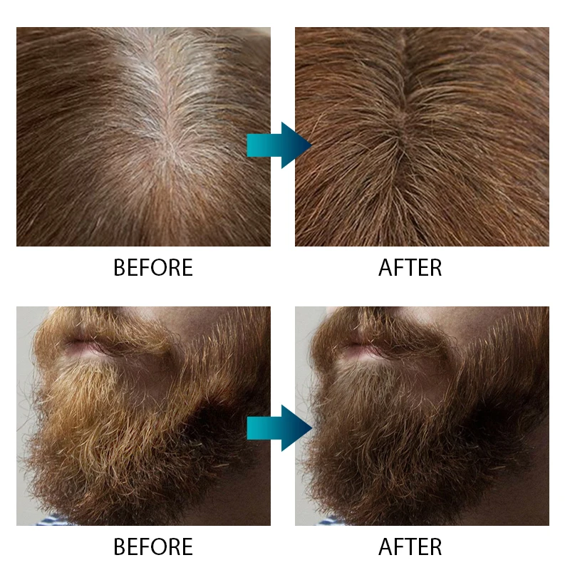 High Quality Grower Shine For Serum Hair Tonic Spray