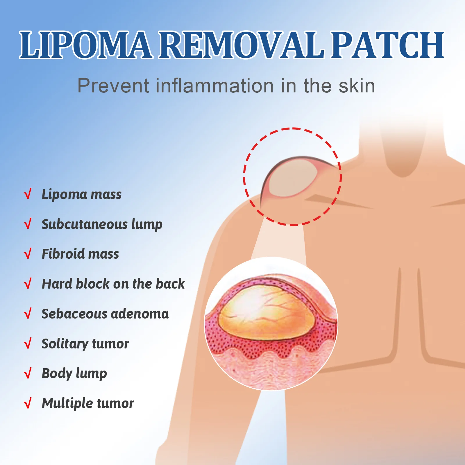 New Arrival Lymphatic Detox Ointment Fat Lump Removal Lumpfree Lipoma Removal patch for Body