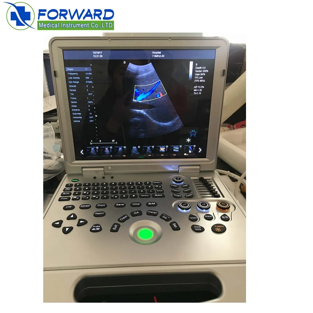 4D laptop portable color doppler ultrasound machine for human