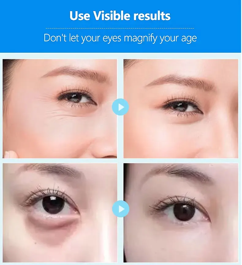 Hot Sale Wholesale Price Eye Hyaluronic Acid Sleep Snail Bio Collagen Eye Patches Purple Collagen Gel Pads Under Eye Mask