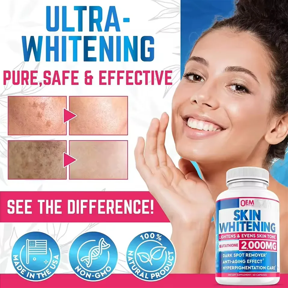 Private Label Oem Whitening Supplement Skin Whitening Pills Best Skin Whitening Pills Softgels Capsules