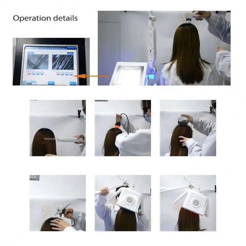 Hair Growth Machine Scalp Massage Devices With Diode Laser Micro Needle Rf Roller Kit Oil Micro-Current Oxygen Red Light Therapy