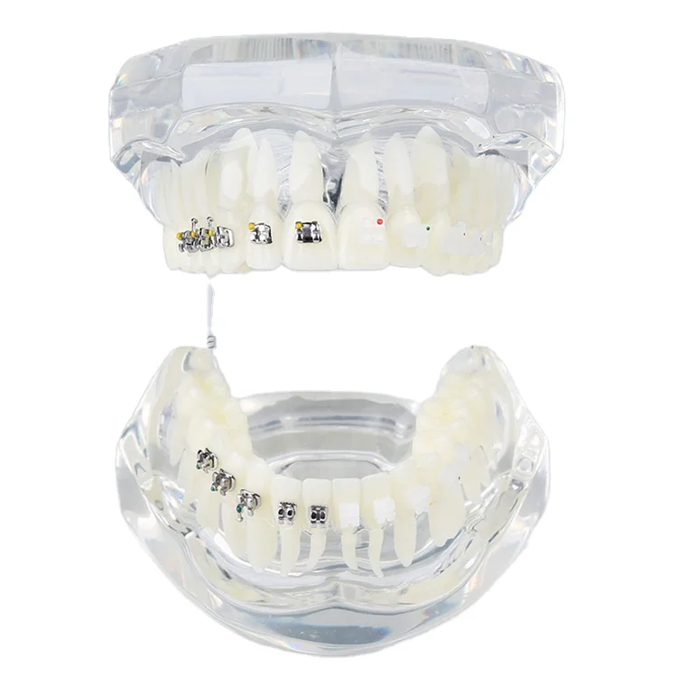 [ Aifan Dental ] Dental Study Model With Metal and Ceramic Brackets Dental Teeth Orthodontic Model
