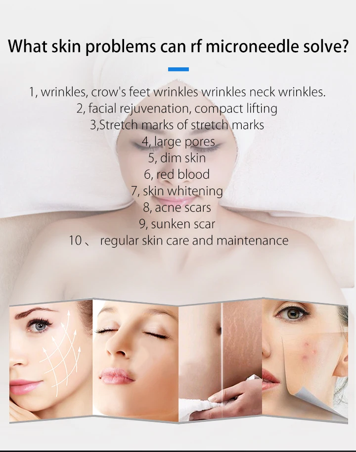 Professional portable fractional rf microneedle device / gold microneedles rf machine