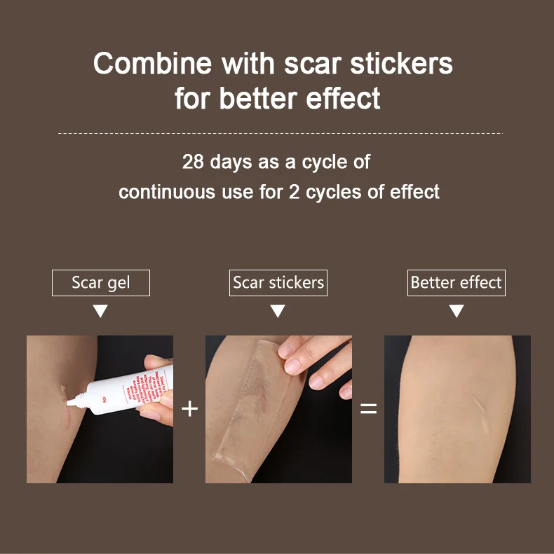 Silica Gel Repair New Product Effectively Removal Cream Silicone Gel Acne Scar