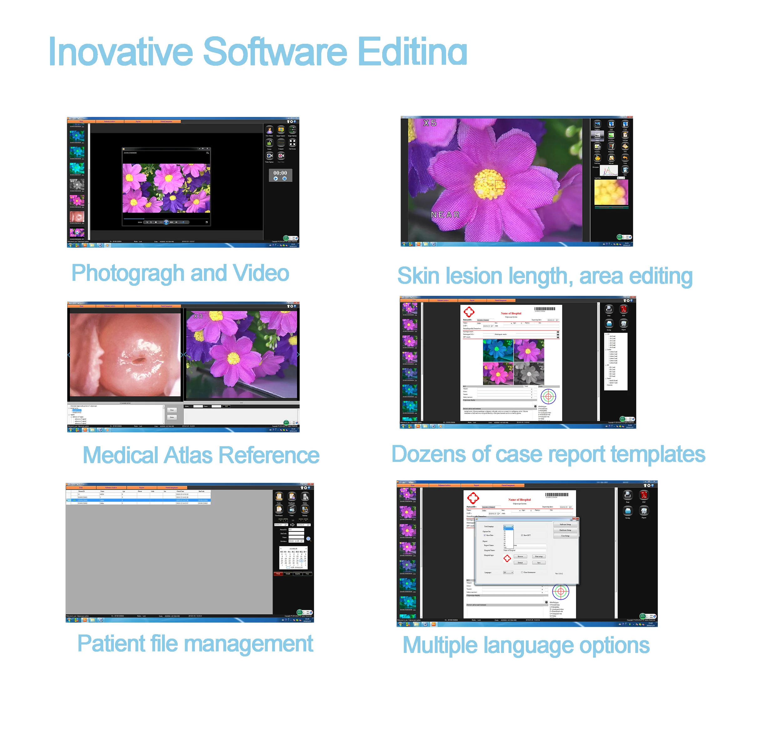 HD optical Colposcope For Vagina Digital Gynecology Colposcopy Video Colposcopio CCD HD Colposcope Camera Module
