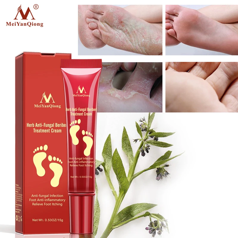 
Foot treatment for dry cracked feet to remove fungus 