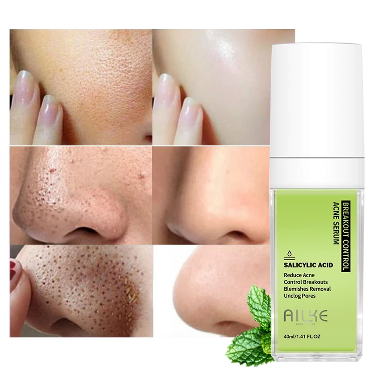 Ailke лучший контроль акне подавляет выпалы восстанавливает поры салициловая кислота лечит уход за кожей сыворотка для лица